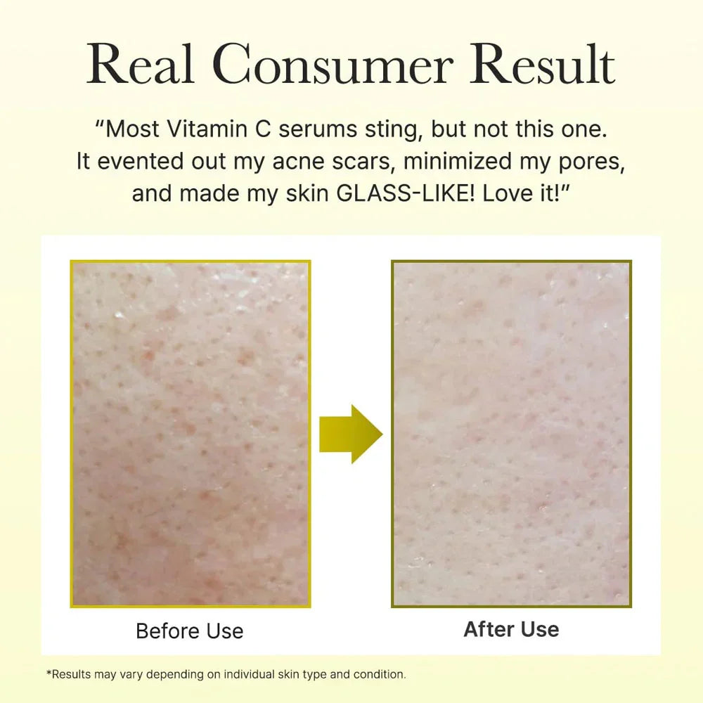 Arencia Vitamin C Booster Shot 30ml